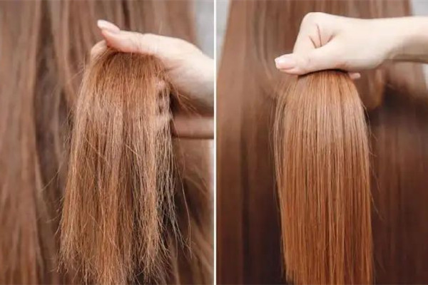 干性頭發(fā)會變成油性頭發(fā)嗎 干性頭發(fā)會導致頭皮屑嗎 干性頭發(fā)會變成油性頭發(fā)嗎 干性頭發(fā)會導致頭皮屑嗎