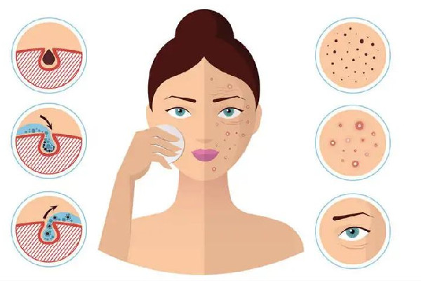 江漢路步行街愛漾皮膚管理中心毛孔清潔怎么樣 江漢路步行街愛漾皮膚管理中心毛孔管理怎么樣 江漢路步行街愛漾皮膚管理中心毛孔清潔怎么樣 江漢路步行街愛漾皮膚管理中心毛孔管理怎么樣