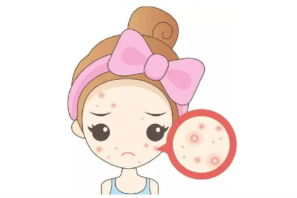 江漢路步行街恩可·科顏醫(yī)治處理痘痘怎么樣 江漢路步行街恩可·科顏醫(yī)環(huán)境好嗎 江漢路步行街恩可·科顏醫(yī)治處理痘痘怎么樣 江漢路步行街恩可·科顏醫(yī)環(huán)境好嗎