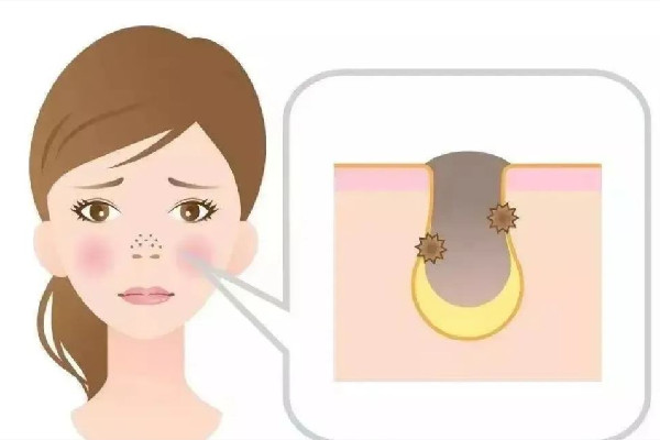 江漢路步行街苗醫(yī)生草本科技祛痘店祛痘怎么樣 江漢路步行街苗醫(yī)生草本科技祛痘店去黑頭效果好嗎 江漢路步行街苗醫(yī)生草本科技祛痘店祛痘怎么樣 江漢路步行街苗醫(yī)生草本科技祛痘店去黑頭效果好嗎