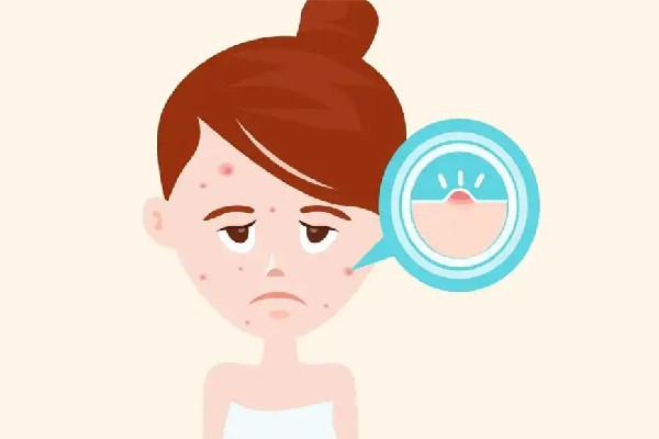 江漢路步行街雅衡詩(shī)蘭皮膚健康管理中心痘痘肌調(diào)理怎么樣 江漢路步行街雅衡詩(shī)蘭皮膚健康管理中心可以脫毛嗎 江漢路步行街雅衡詩(shī)蘭皮膚健康管理中心痘痘肌調(diào)理怎么樣 江漢路步行街雅衡詩(shī)蘭皮膚健康管理中心可以脫毛嗎