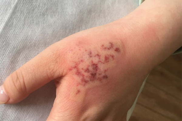 江漢路步行街眾刺紋畫(huà)·穿刺·洗紋身·遮蓋店洗紋身會(huì)疼嗎 洗紋身的方法有幾種 江漢路步行街眾刺紋畫(huà)·穿刺·洗紋身·遮蓋店洗紋身會(huì)疼嗎 洗紋身的方法有幾種