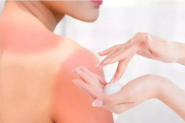 光谷EM輕松時刻科技美容面部修復(fù)項目感覺怎么樣 曬后修復(fù)用蘆薈膠有用嗎 光谷EM輕松時刻科技美容面部修復(fù)項目感覺怎么樣 曬后修復(fù)用蘆薈膠有用嗎