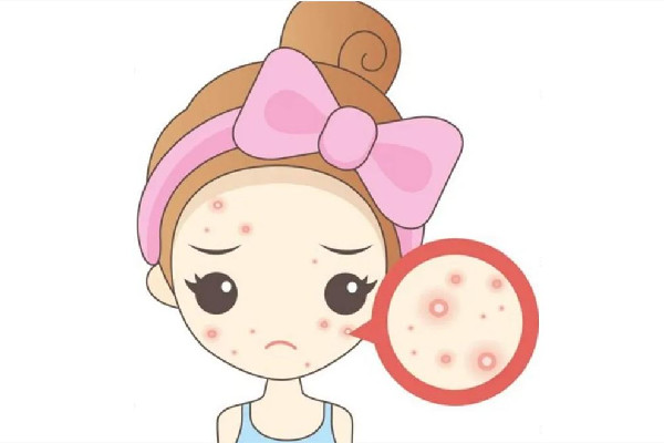 光谷天地傾顏皮膚管理中心痘痘肌護(hù)理效果怎么樣 痘痘肌多久可以改善過來 光谷天地傾顏皮膚管理中心痘痘肌護(hù)理效果怎么樣 痘痘肌多久可以改善過來