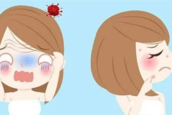 水果湖清顏堂專業(yè)祛痘手法怎么樣 背部長痘痘是什么原因造成 水果湖清顏堂專業(yè)祛痘手法怎么樣 背部長痘痘是什么原因造成