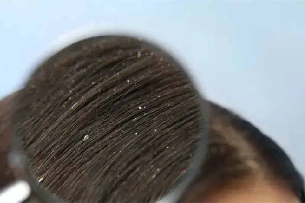 水果湖煥顏堂健康養(yǎng)生中心頭皮清潔項目做的怎么樣 頭皮清潔有必要做嗎 水果湖煥顏堂健康養(yǎng)生中心頭皮清潔項目做的怎么樣 頭皮清潔有必要做嗎