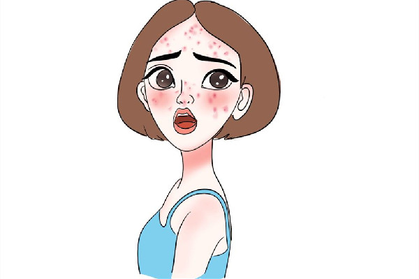 積玉橋vup·科技美膚·祛斑·祛痘連鎖痘痘肌護理怎么樣 痘痘肌用什洗面奶 積玉橋vup·科技美膚·祛斑·祛痘連鎖痘痘肌護理怎么樣 痘痘肌用什洗面奶