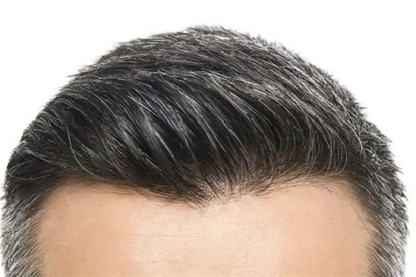 白頭發(fā)染了會(huì)越來(lái)越多嗎 白頭發(fā)染黑能維持多久 白頭發(fā)染了會(huì)越來(lái)越多嗎 白頭發(fā)染黑能維持多久