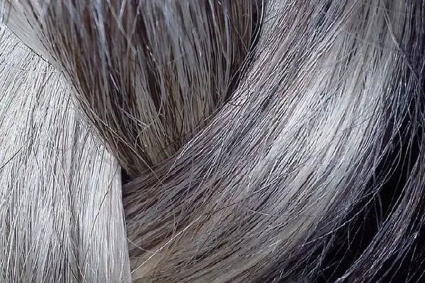 白頭發(fā)多是體內(nèi)缺少什么元素 白頭發(fā)補維生素b幾 白頭發(fā)多是體內(nèi)缺少什么元素 白頭發(fā)補維生素b幾