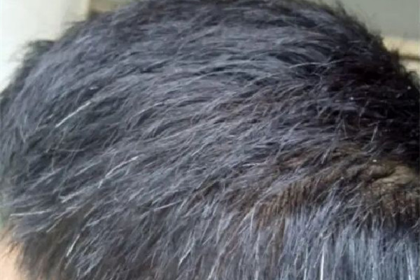 白頭發(fā)用什么洗發(fā)水洗才能變黑 白頭發(fā)用洗發(fā)水可以變黑嗎 白頭發(fā)用什么洗發(fā)水洗才能變黑 白頭發(fā)用洗發(fā)水可以變黑嗎