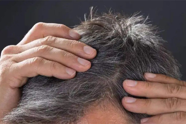 白頭發(fā)越來越多是身體哪里有問題 白頭發(fā)多和腎虛有關(guān)系嗎 白頭發(fā)越來越多是身體哪里有問題 白頭發(fā)多和腎虛有關(guān)系嗎