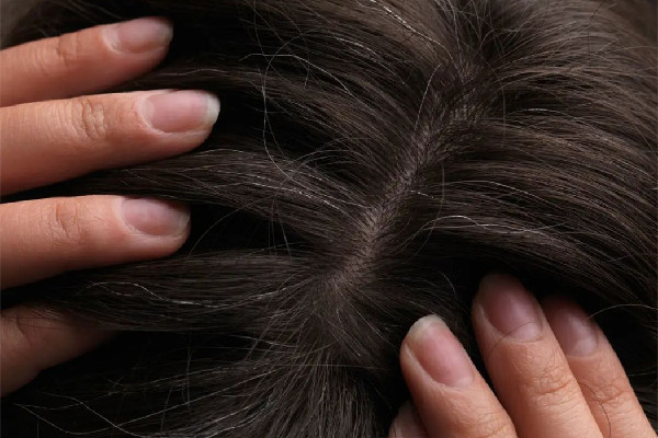 白頭發(fā)染了會(huì)越來(lái)越多嗎 白頭發(fā)染黑能維持多久 白頭發(fā)染了會(huì)越來(lái)越多嗎 白頭發(fā)染黑能維持多久