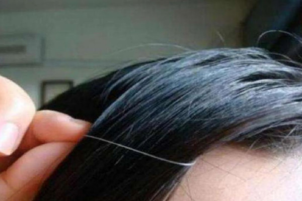 白頭發(fā)可以逆轉(zhuǎn)嗎 白頭發(fā)還能變黑嗎 白頭發(fā)可以逆轉(zhuǎn)嗎 白頭發(fā)還能變黑嗎