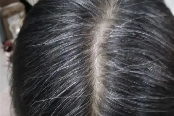 白頭發(fā)染色怎么染不上 白頭發(fā)染黑對身體有影響嗎 白頭發(fā)染色怎么染不上 白頭發(fā)染黑對身體有影響嗎
