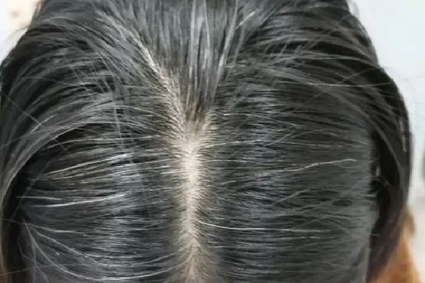 白頭發(fā)從哪開始白 白頭發(fā)為什么會越來越多 白頭發(fā)從哪開始白 白頭發(fā)為什么會越來越多