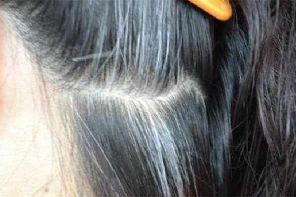 白頭發(fā)用什么洗發(fā)水洗才能變黑 白頭發(fā)用洗發(fā)水可以變黑嗎 白頭發(fā)用什么洗發(fā)水洗才能變黑 白頭發(fā)用洗發(fā)水可以變黑嗎