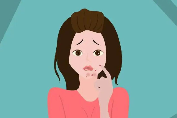 中南路漾膚皮膚管理店痘肌護(hù)理項(xiàng)目怎么樣 痘痘肌護(hù)理注意事項(xiàng) 中南路漾膚皮膚管理店痘肌護(hù)理項(xiàng)目怎么樣 痘痘肌護(hù)理注意事項(xiàng)