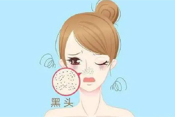 中南路MY科技纖體美膚連鎖店改善黑頭項(xiàng)目做完后怎么樣 改善黑頭粉刺的方法 中南路MY科技纖體美膚連鎖店改善黑頭項(xiàng)目做完后怎么樣 改善黑頭粉刺的方法