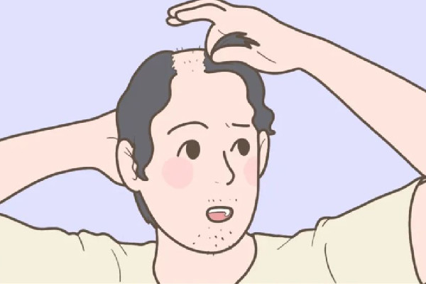 掉發(fā)吃什么食物調(diào)理 掉發(fā)吃維生素b6多久才能見效 掉發(fā)吃什么食物調(diào)理 掉發(fā)吃維生素b6多久才能見效