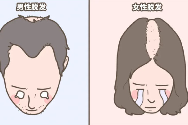 掉發(fā)有白色顆粒是什么 掉發(fā)有白色毛囊還會(huì)在長(zhǎng)嗎 掉發(fā)有白色顆粒是什么 掉發(fā)有白色毛囊還會(huì)在長(zhǎng)嗎