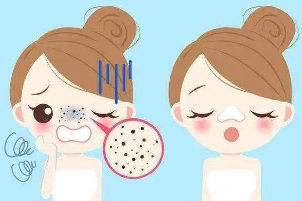 中南路夢(mèng)都?巴厘女子SPA養(yǎng)生會(huì)所去黑頭后效果怎么樣 去黑頭可以