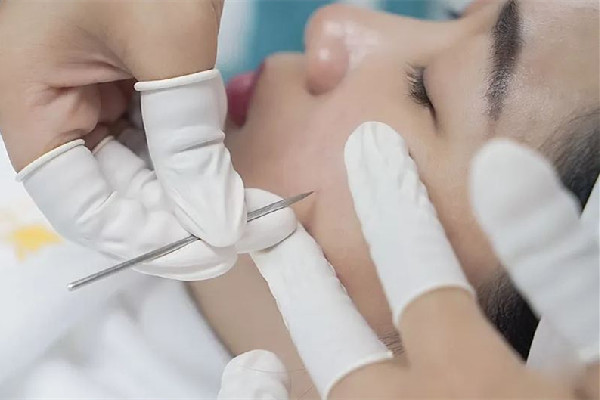 中南路熙格輕奢皮膚管理店針清項(xiàng)目怎么樣 針清有依賴性嗎 中南路熙格輕奢皮膚管理店針清項(xiàng)目怎么樣 針清有依賴性嗎