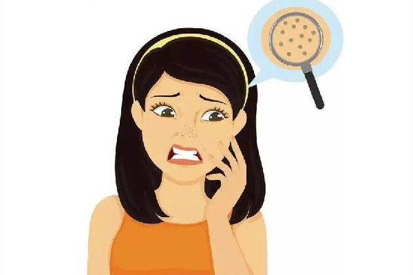 中南路佐康專業(yè)祛痘店去黑頭后感覺(jué)好嗎 去一次黑頭能管多久