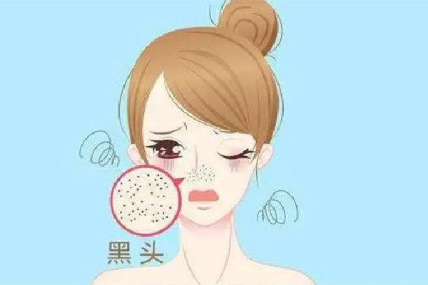 中南路佐康專業(yè)祛痘店去黑頭后感覺(jué)好嗎 去一次黑頭能管多久