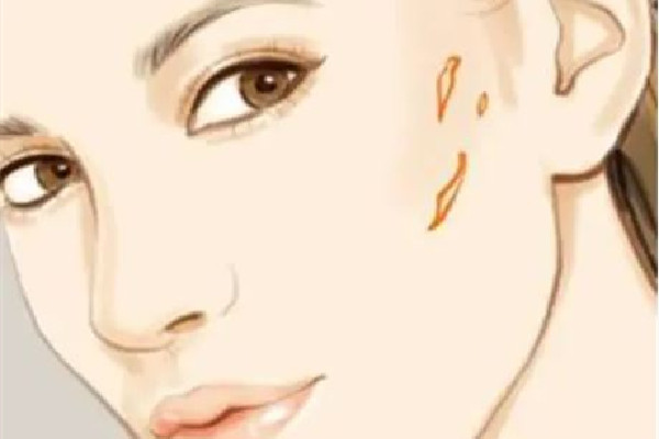 中南路欣奕除疤祛痘全國連鎖機構(gòu)祛疤效果怎么樣 祛疤是越早越好嗎 中南路欣奕除疤祛痘全國連鎖機構(gòu)祛疤效果怎么樣 祛疤是越早越好嗎