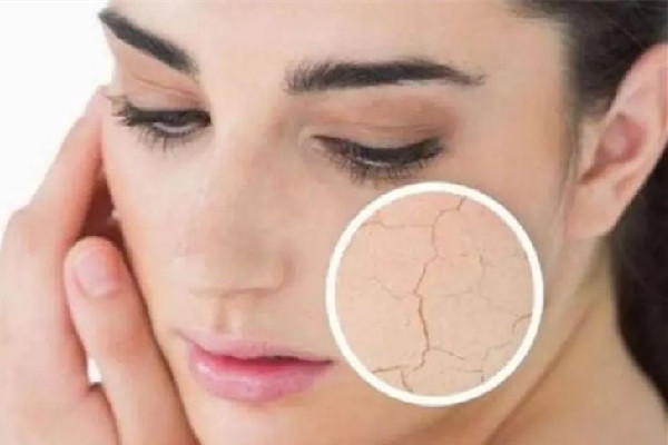 中南路丹鳳眼國(guó)際眼部美容連鎖機(jī)構(gòu)可以緩解面部干燥嗎 面部干燥怎么補(bǔ)水效果好 中南路丹鳳眼國(guó)際眼部美容連鎖機(jī)構(gòu)可以緩解面部干燥嗎 面部干燥怎么補(bǔ)水效果好