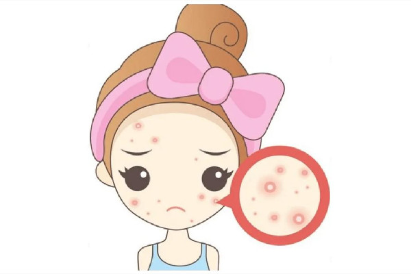 中南路Comely Lady美學中心店痘肌清潔怎么樣 痘肌多久用一次清潔面膜 中南路Comely Lady美學中心店痘肌清潔怎么樣 痘肌多久用一次清潔面膜