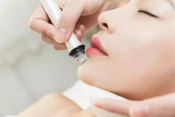 后湖SOR索爾祛痘?面部肌膚科學(xué)管理小氣泡項目感覺好嗎 小氣泡有收縮毛孔作用嗎 后湖SOR索爾祛痘?面部肌膚科學(xué)管理小氣泡項目感覺好嗎 小氣泡有收縮毛孔作用嗎