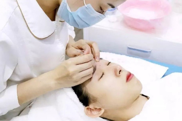 后湖SOR索爾祛痘?面部肌膚科學(xué)管理針清效果怎么樣 針清會(huì)讓毛孔變大嗎 后湖SOR索爾祛痘?面部肌膚科學(xué)管理針清效果怎么樣 針清會(huì)讓毛孔變大嗎