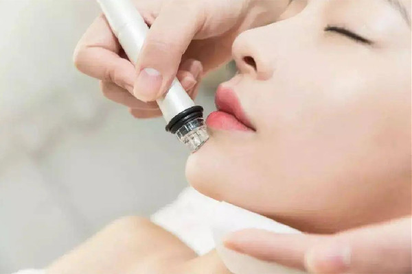 后湖武漢美加立芳醫(yī)療美容門(mén)診部小氣泡項(xiàng)目體驗(yàn)感怎么樣 小氣泡有必要一周做一次嗎 后湖武漢美加立芳醫(yī)療美容門(mén)診部小氣泡項(xiàng)目體驗(yàn)感怎么樣 小氣泡有必要一周做一次嗎