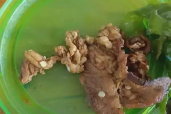 學(xué)生質(zhì)疑店家賣淋巴肉被威脅 淋巴肉吃了會怎樣 學(xué)生質(zhì)疑店家賣淋巴肉被威脅 淋巴肉吃了會怎樣