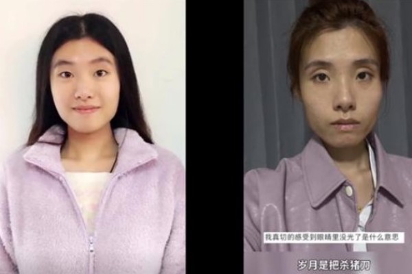 女子工作5年前后對比判若兩人 工作壓力大睡不好怎么辦 女子工作5年前后對比判若兩人 工作壓力大睡不好怎么辦