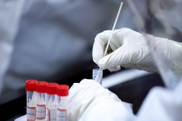 核酸機構(gòu)造假頻現(xiàn) 官方:嚴肅處置 專家:核酸檢測公司該不該上市 核酸機構(gòu)造假頻現(xiàn) 官方:嚴肅處置 專家:核酸檢測公司該不該上市