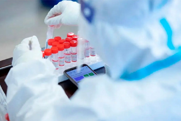 官方:抗原陽性需報備陰性正常生活 抗原檢測兩條杠一定是陽性嗎 官方:抗原陽性需報備陰性正常生活 抗原檢測兩條杠一定是陽性嗎