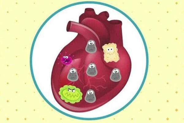 心肌炎有什么癥狀和表現(xiàn) 心肌炎會發(fā)燒嗎 心肌炎有什么癥狀和表現(xiàn) 心肌炎會發(fā)燒嗎