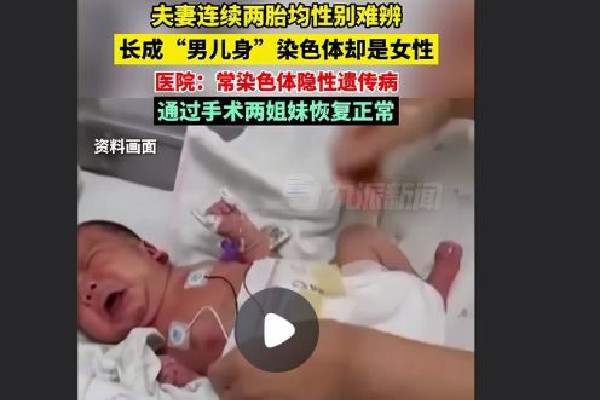 夫妻連生兩胎均患怪病性別難辨 懷孕的時候能檢查出孩子那些問題 夫妻連生兩胎均患怪病性別難辨 懷孕的時候能檢查出孩子那些問題