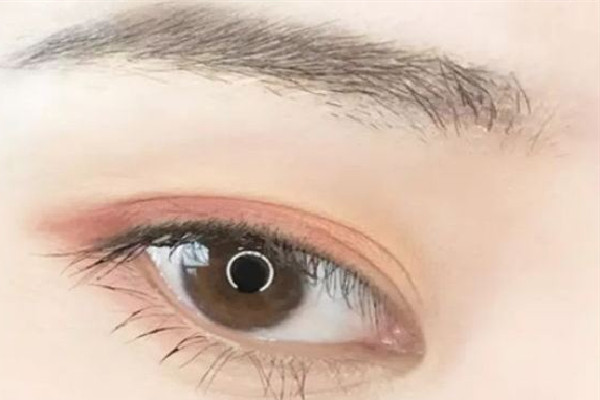 五旬男子因剛割雙眼皮開車撞上護欄 雙眼皮割完后要注意的問題有哪些 五旬男子因剛割雙眼皮開車撞上護欄 雙眼皮割完后要注意的問題有哪些