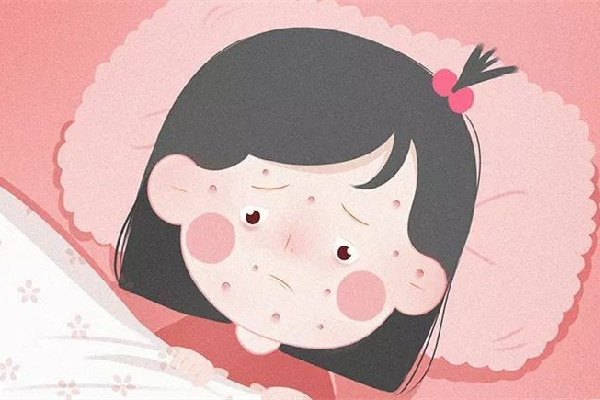 超90%的成人體內(nèi)有水痘帶狀皰疹病毒 水痘帶狀皰疹會自愈嗎 超90%的成人體內(nèi)有水痘帶狀皰疹病毒 水痘帶狀皰疹會自愈嗎