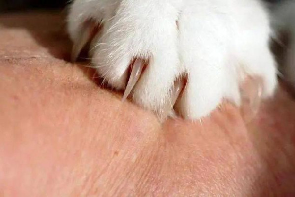 男子擼貓后淋巴結(jié)腫大高燒不退 被貓抓了怎么判斷沒事 男子擼貓后淋巴結(jié)腫大高燒不退 被貓抓了怎么判斷沒事