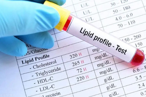 血脂檢測(cè)為何有必要從娃娃抓起 血脂檢測(cè)包括哪些項(xiàng)目 血脂檢測(cè)為何有必要從娃娃抓起 血脂檢測(cè)包括哪些項(xiàng)目