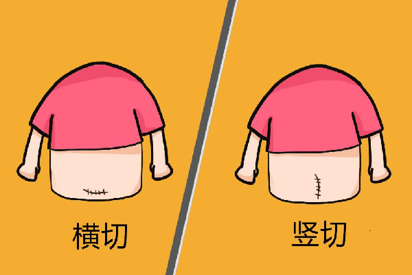 官方回應(yīng)男子大罵剖腹產(chǎn)妻子 剖腹產(chǎn)之后要注意什么 官方回應(yīng)男子大罵剖腹產(chǎn)妻子 剖腹產(chǎn)之后要注意什么